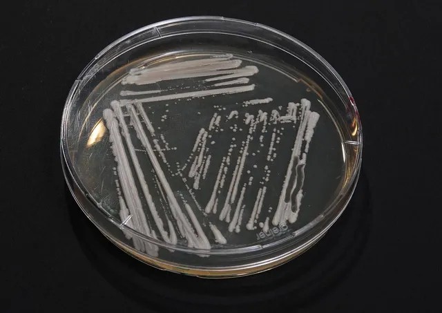 Forscher finden Palmöl-Ersatz