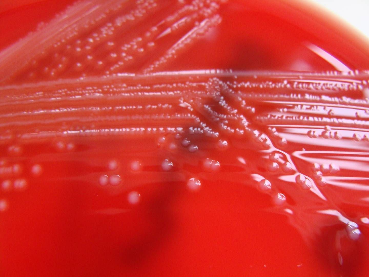 2021-11-20---listeria-monocytogenes-columbia-horse-blood-agar-detail-jpg-imagine-e81818_d13e3a_1440_1080